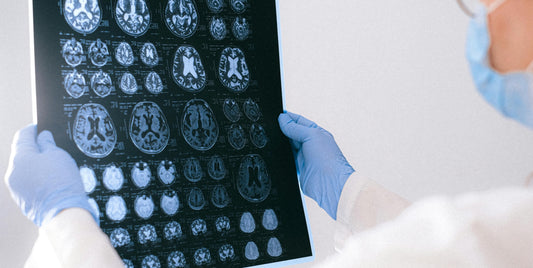 Un médecin qui tient dans les mains une radiographie d'un cerveau humain